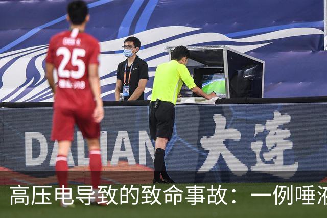 高压电导致的致命事故：一例唾液导电性的探讨